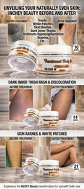 TREATMENT BODY CREAM 200ML