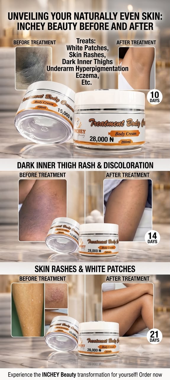 TREATMENT BODY CREAM 200ML