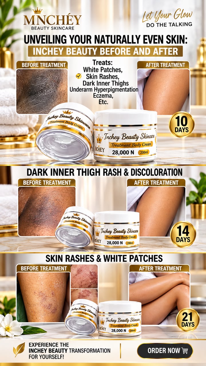 TREATMENT BODY CREAM 200ML